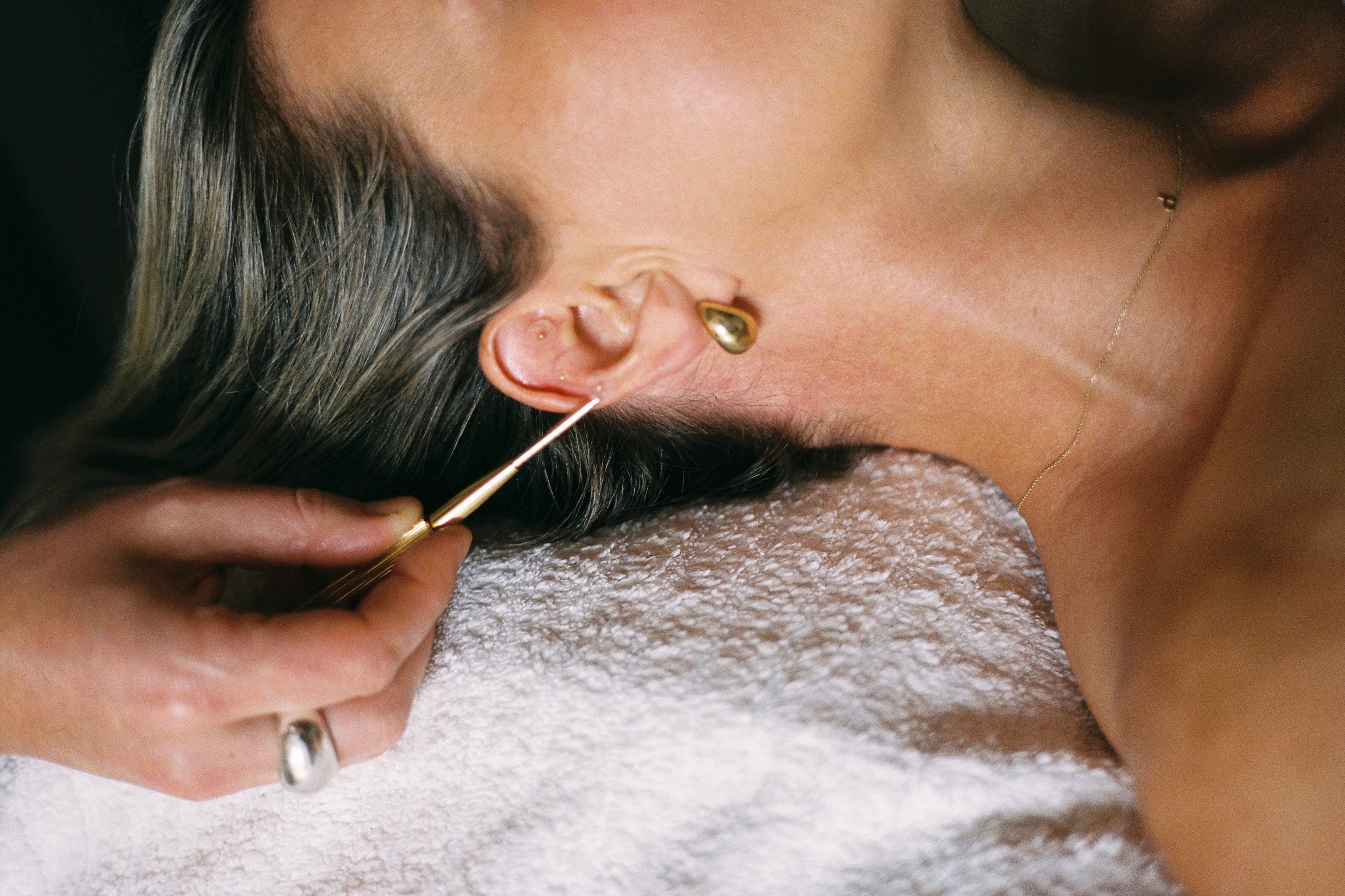 Ear Seeding in Currumbin Waters, Gold Coast: What to Expect